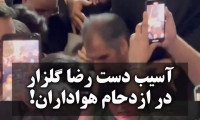 اسیب دیدن دست